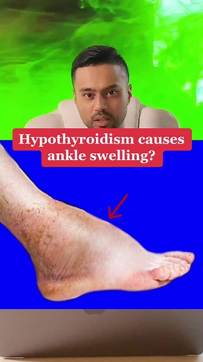 The Good Foot Doctor - Ram on TikTok