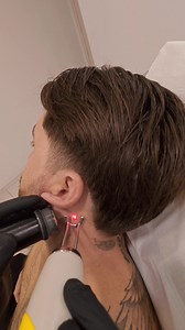 40K views · 147 reactions | New Laser Pico Vario pulse! | Thirio Tattoo Removal | Facebook