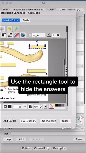HOW TO STUDY ANATOMY: ANKI image occlusion
