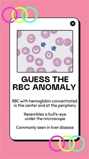 Guess the RBC ANOMALY #5 | Hematology Review