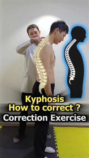🎯 Correction Kyphosis.💯 Best Exercises #ortospine,#ortopedutebaev, #kyphosis,#lordosis,#scoliosis,