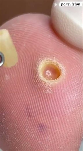 This Corn Had a DEEP ROOT! 🦶 (Core Extraction)