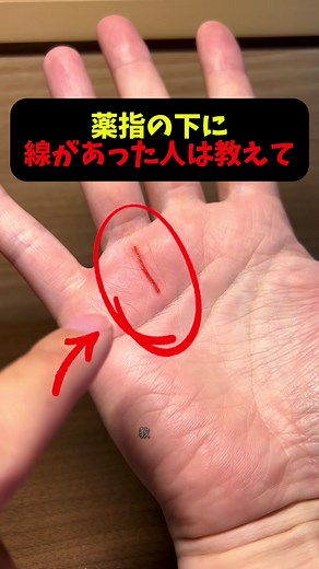 太陽線とは？手相で見る意味と見つけ方
