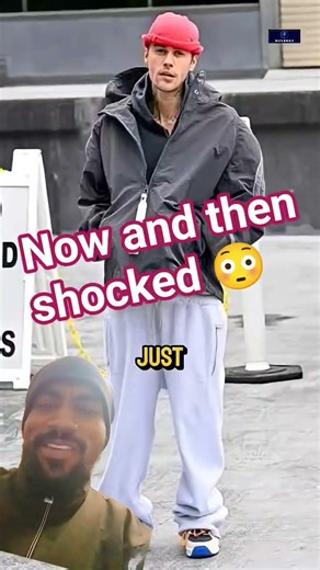 Justin Bieber viral shorts now & then shocked 😳 #youtubeshorts #shorts #trending #viral