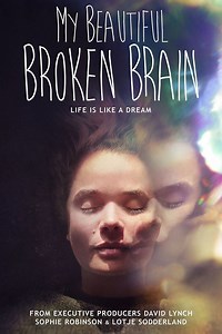My Beautiful Broken Brain - Alchetron, the free social encyclopedia