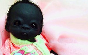 4个不可思议天生异类的婴儿，你觉得哪个最奇葩？一次次刷新认知！_哔哩哔哩_bilibili