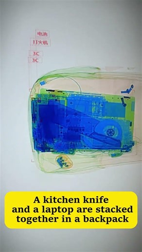 What exactly do hospital security screenings detect? #hindisong #science #viral #tech #foryou #xray