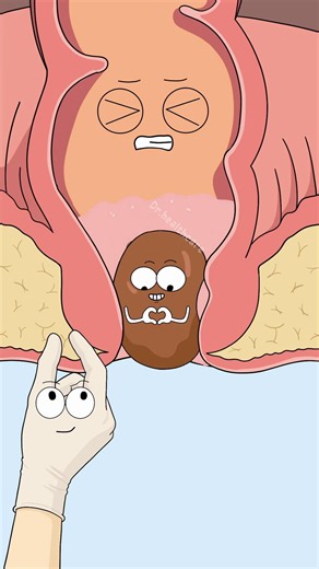 Can A Suppository Remove Hemorrhoids?