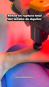 Una ruptura total del tendón de Aquiles es el desgarro ocurre en un estiramiento brusco del tendón, lo que causa un dolor agudo, un chasquido audible y la incapacidad para caminar o ponerse de puntas. esta lesión requiere de cirugía para poder reconstruir el tendón y posteriormente de un proceso de rehabilitación física que puede durar de tres a seis meses dependiendo de la evolución del paciente #fisio360 #pachuca #fisioterapia #rehab #fisio #rehabilitación #hidalgo #physio #pachucadesoto #mara