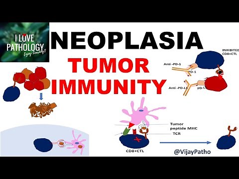 NEOPLASIA 9: TUMOR IMMUNITY: tumor antigens, Evasion of tumor immunity