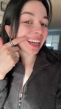 Invisalign reveal ✨