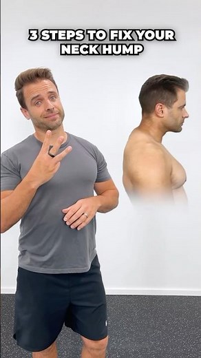 Fix Your Neck Hump In Just 3 Steps! (Super Effective)