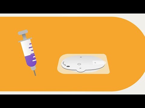 Omnipod® 5 Automated Insulin Delivery System Product Training - Pod Activation