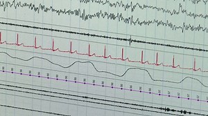 EEG Wave In Human Brain, Abnormal EEG, Brain Wave On Electroencephalogram ,EEG Video, Close-up plan