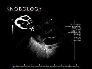 Ultrasound principles - INTENSIVE