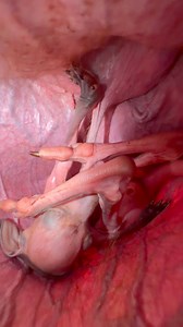 722K views · 2.6K reactions | OMG!  Did You Know This Is What A Baby Kangaroo Looks Like Inside Its Mom’s Pouch Come Visit Our AMAZING Animals book a tour now at AnimalEDventures.com | Animal EDventure Park & Safari | Facebook