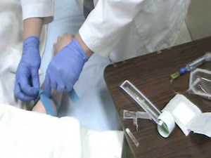 Peripheral IV Insertion