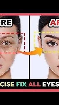 ♨️Only 3 mins!! Eye rejuvenation. Get rid oF under eye wrinkles, dark circles, eye bags,Crow's feet