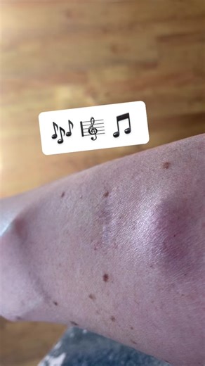 Exploring Subdermal Implants in Body Piercing