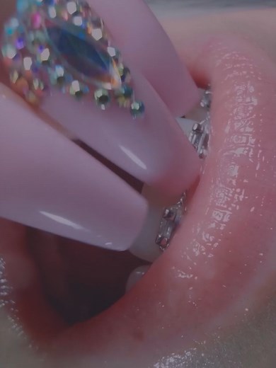 Brace Tapping ASMR: Experience Relaxation