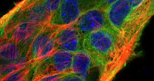 How megakaryocytes get so big — and the bad things that happen when they don’t