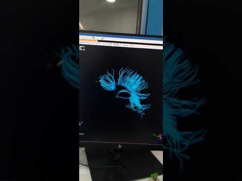 POST PROCESSING OF DTI TRACTOGRAPHY