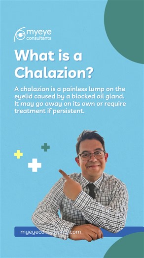 Understanding Chalazion: Treatment & Eye Care Tips