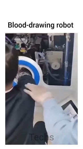 Technology🔹️Gadgets on Instagram: "The blood-drawing robot developed by Beijing Magicnurse Surgical Robot Technology Co., Ltd in Hangzhou, China, boasts a high success rate of 94.3%, showcasing advancements in automation and medical technology aimed at improving patient care and reducing human error during blood collection procedures. #blood #robot #drawing"