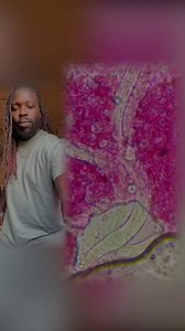 88K views · 983 reactions | Lipstick under the microscope  | Chaz Bruce | Facebook