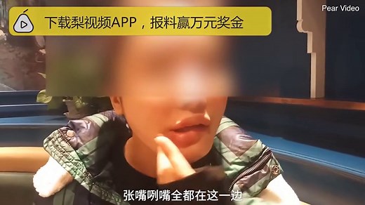 Plastic surgery gone wrong leaves woman with lopsided mouth