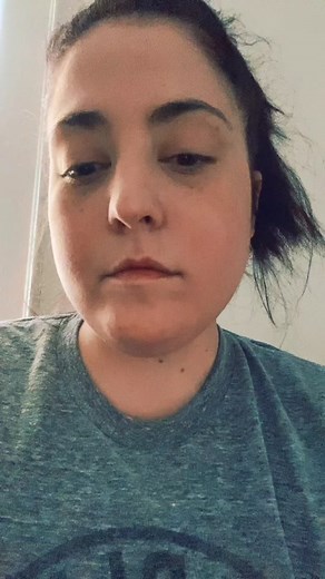 #cirrhosis #alcoholism #candid