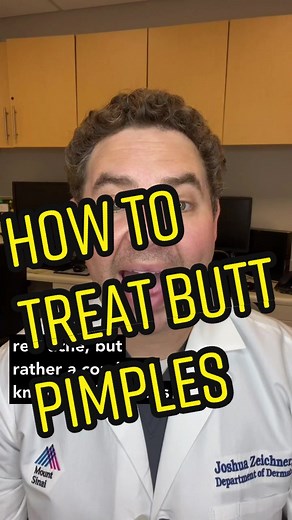Effective Ways to Treat Butt Pimples