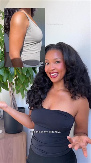 Andrea on Instagram: "#AveenoPartner Loving the results of my daily skin strength ritual using @aveenous Skin Relief Moisturizing Lotion and Healing Ointment. Get stronger with me as we hydrate our skin for the chilly months ahead – shop the link in my bio! #GSWM #skincaretips #selfconfidence"