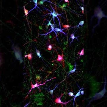 New stem cell toolkit could unlock some of the biggest questions in Parkinson's disease research