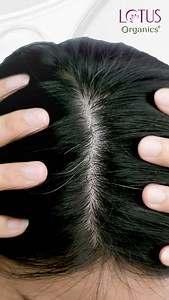 1.2K reactions | What if your hair care actually cared for your scalp? The Lotus Organics+ Hair Growth Serum goes beyond surface-level shine and reactivates dormant hair follicles, strengthens from root to tip, and brings your scalp back to balance. No fillers. No fluff. Just fuller, healthier hair, naturally. Grow what’s yours, the organic way. #HairCare #HairGrowthSerum #OrganicIngredients #Organic #LotusOrganicsPlus #NaturalHairGrowth | Lotus Organics + | Facebook