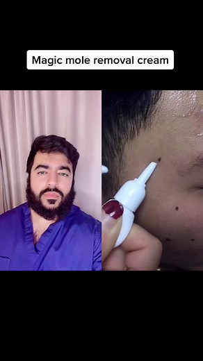 Effective Mole Removal Creams: Do They Really Work?