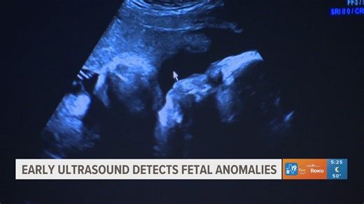 Early ultrasound detects fetal anomalies