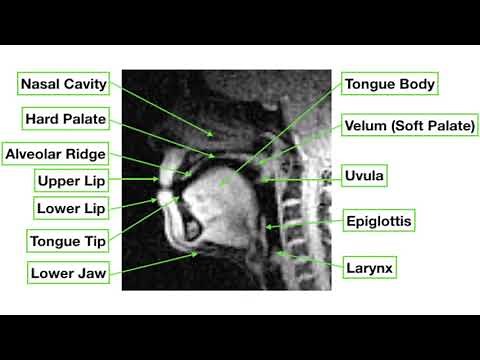 Vocal Tract MRI Shows The Complexity of Speech