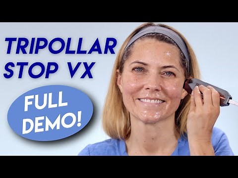 Tripollar Stop Vx Demo - Radio Frequency + Before and After - Over 40