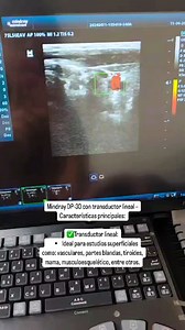 Mindray DP-30 con transductor lineal de segunda en perfecto estado. 1. Tipo de equipo: • Ecógrafo portátil y compacto en blanco y negro. 2. Transductor lineal: • Ideal para estudios superficiales como: vasculares, partes blandas, tiroides, mama, musculoesquelético, entre otros. 3. Tecnología de imagen: • iClear™: Mejora el contraste y la definición de bordes. • iBeam™: Composición espacial de imágenes para una mejor resolución. • TSI (Tissue Specific Imaging): Optimiza la calidad de imagen de ac