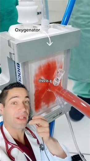 This machine can replace your lungs!