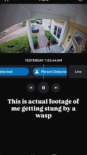 Purvisha Patel MD on Instagram: "To treat a wasp sting effectively, follow these steps: 1. Remove the Stinger: If the stinger is left in the skin (more common with bees), gently scrape it out with a flat object like a credit card. Wasps typically do not leave a stinger. 2. Clean the Area: Wash the sting site with soap and water to prevent infection. 3. Apply a Cold Compress: Use a cold pack or a cloth with ice wrapped in it on the sting area for about 10-15 minutes. This helps reduce swelling an