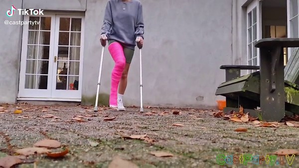 Long Leg Cast #brokenfoot join our patreon.com/castpartytv for all of our videos.