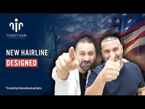 NEW HAIRLINE DESIGNED!