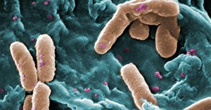 Quelle est la différence entre une bactérie et un virus ?