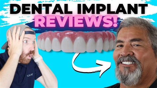Three people share their dental implant reviews about getting permanent teeth in only 24 hours. - - - - - - - How Much Do Dental Implants Cost?? Find out NOW: https://bit.ly/4ohBQzt 60-Second Eligibility Quiz: https://bit.ly/4qbZoHL | Nuvia Dental Implant Center