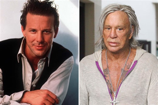 Mickey Rourke plastic surgery: What procedures he had after breaking nose twice