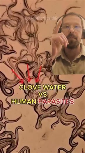 1M views · 15K reactions | Vermifugez-vous à chaque changement de...