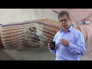 Paediatric iv cannulation and securing the iv.