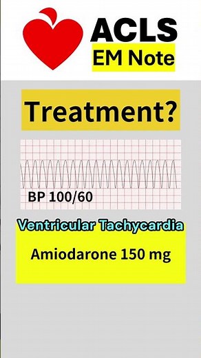 ACLS Rhyrhm Test #acls